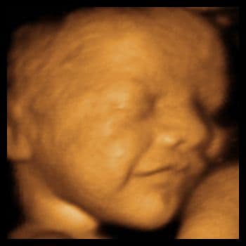 Goshen Medical Imaging